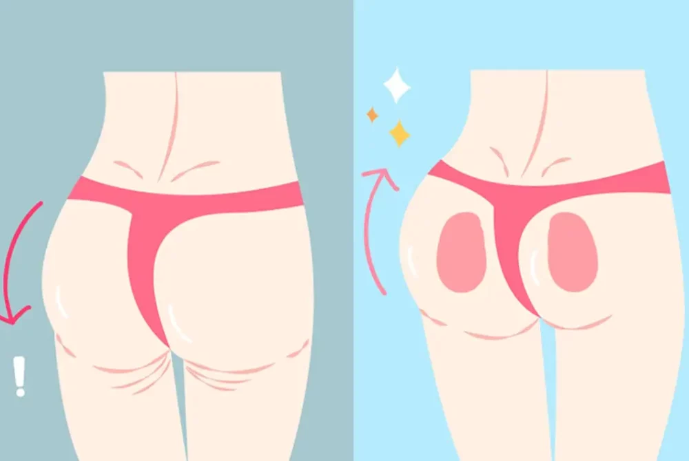 brazilian-butt-lift-fat-injection-medica.com_.sa-riyadh