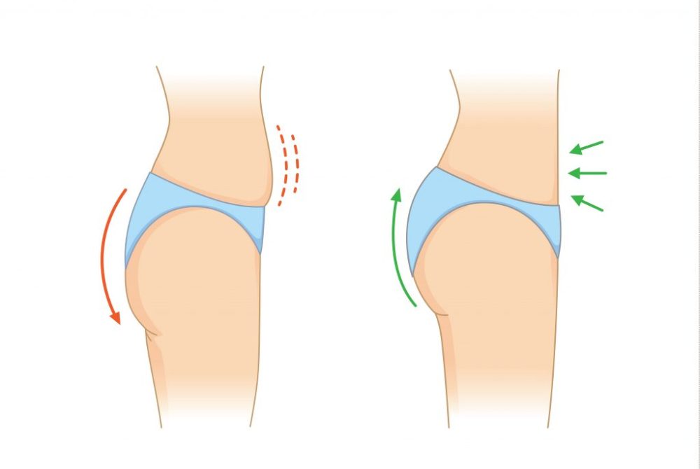 reduce-fat-and-cellulite-at-buttock-and-abdomen-for-beauty-shape-img-blog-compressor-1024x709